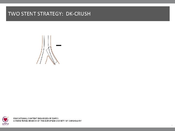 TWO STENT STRATEGY: DK-CRUSH . EDUCATIONAL CONTENT ENDORSED BY EAPCI, A REGISTERED BRANCH OF