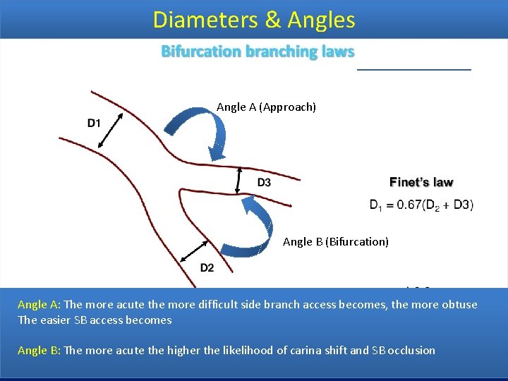 Diameters & Angles Angle A (Approach) Angle B (Bifurcation) Angle A: The more acute