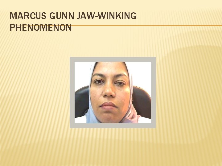 MARCUS GUNN JAW-WINKING PHENOMENON 