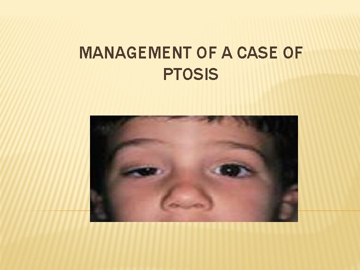 MANAGEMENT OF A CASE OF PTOSIS 