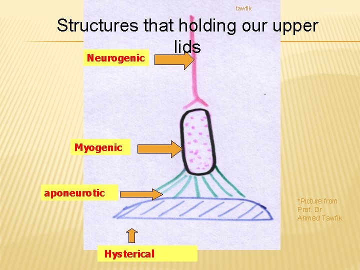 tawfik Structures that holding our upper lids Neurogenic Myogenic aponeurotic mechanical Hysterical *Picture from