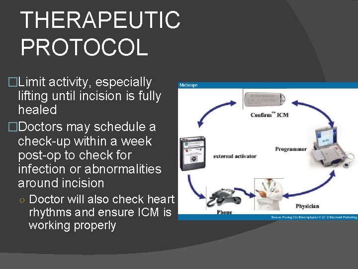 THERAPEUTIC PROTOCOL �Limit activity, especially lifting until incision is fully healed �Doctors may schedule