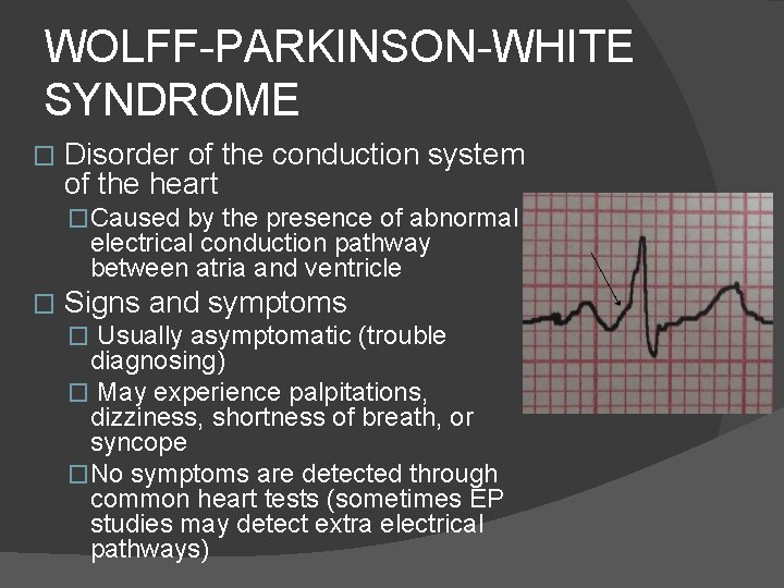 WOLFF-PARKINSON-WHITE SYNDROME � Disorder of the conduction system of the heart �Caused by the