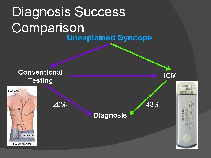 Diagnosis Success Comparison Unexplained Syncope Conventional Testing ICM 43% 20% Diagnosis 