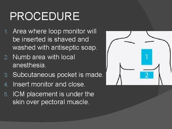 PROCEDURE 1. 2. 3. 4. 5. Area where loop monitor will be inserted is