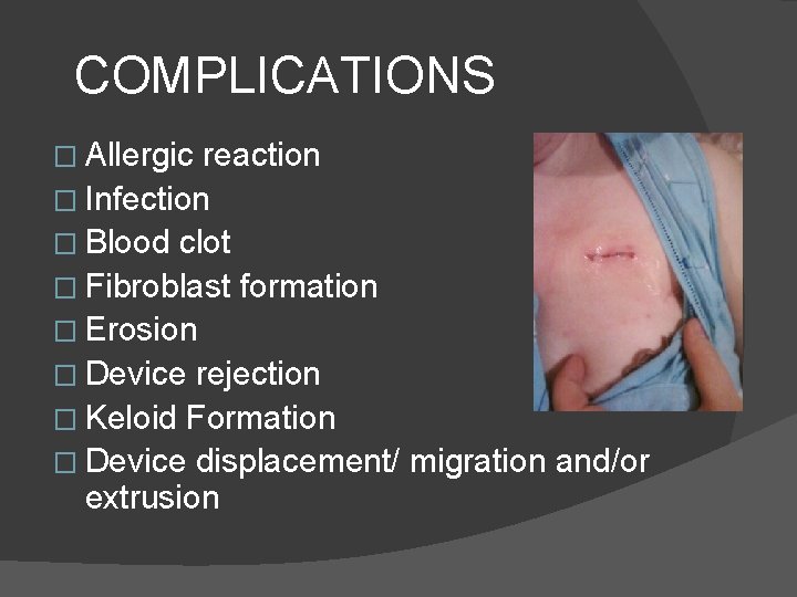 COMPLICATIONS � Allergic reaction � Infection � Blood clot � Fibroblast formation � Erosion
