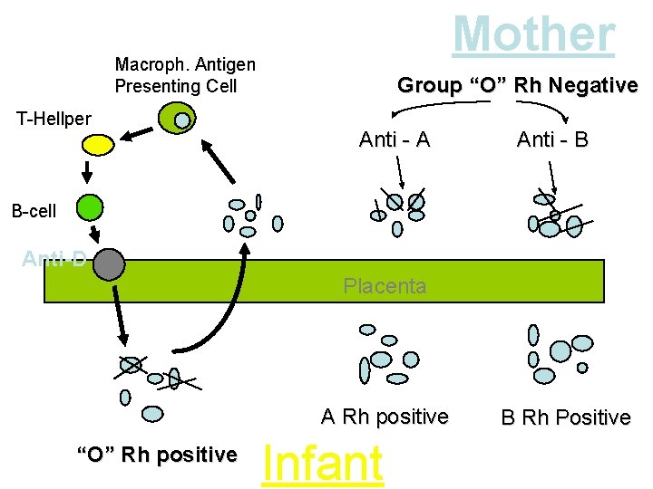 Mother Macroph. Antigen Presenting Cell T-Hellper Group “O” Rh Negative Anti - A Anti