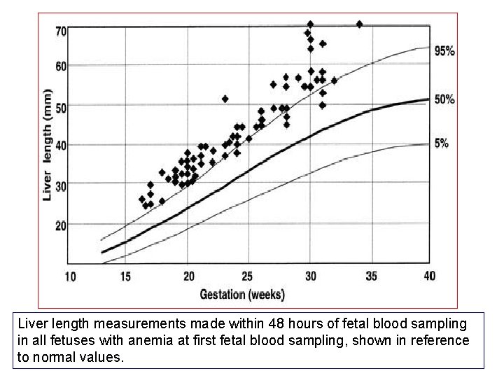 Liver length measurements made within 48 hours of fetal blood sampling in all fetuses