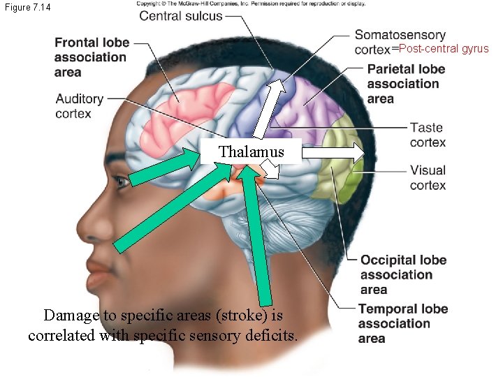 Figure 7. 14 =Post-central gyrus Thalamus Damage to specific areas (stroke) is correlated with