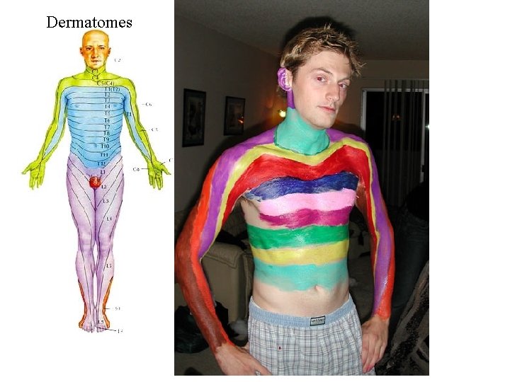 Dermatomes 