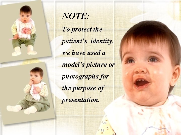 NOTE: To protect the patient’s identity, we have used a model’s picture or photographs