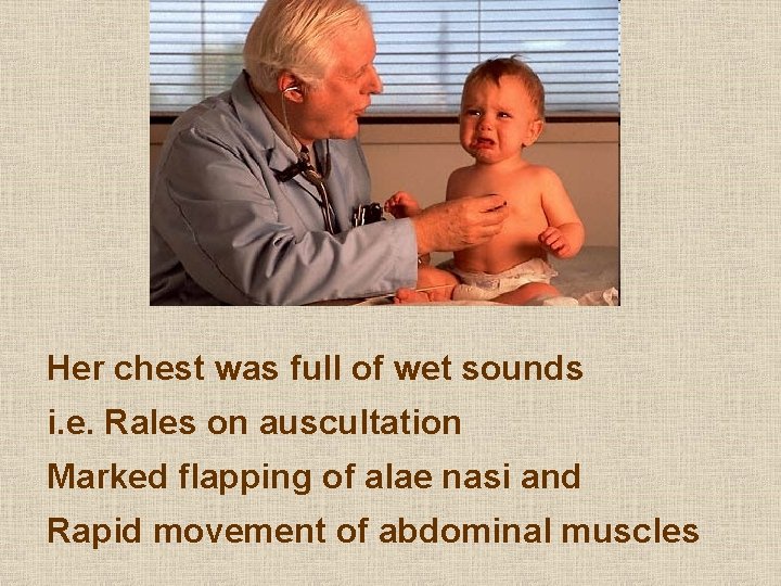 Her chest was full of wet sounds i. e. Rales on auscultation Marked flapping