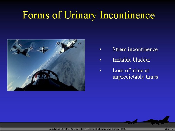 Forms of Urinary Incontinence • Stress incontinence • Irritable bladder • Loss of urine