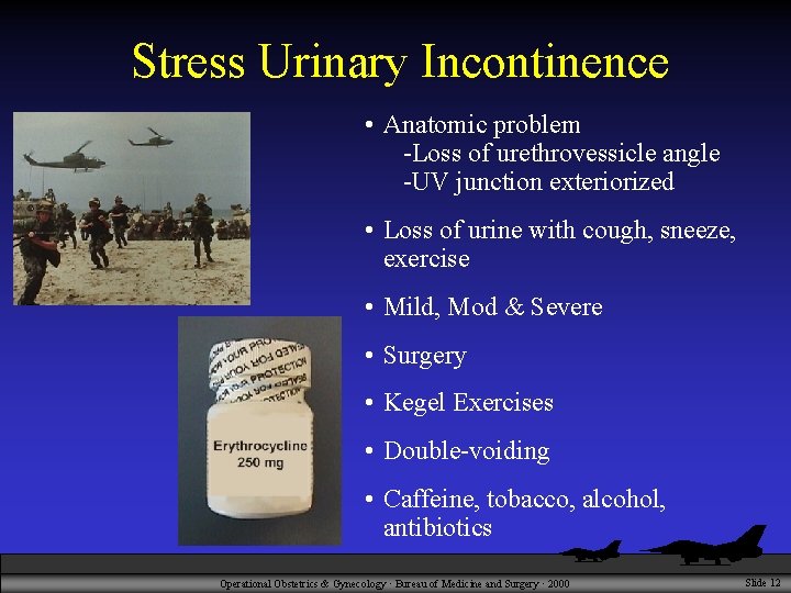 Stress Urinary Incontinence • Anatomic problem -Loss of urethrovessicle angle -UV junction exteriorized •