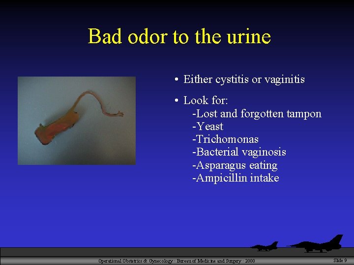 Bad odor to the urine • Either cystitis or vaginitis • Look for: -Lost
