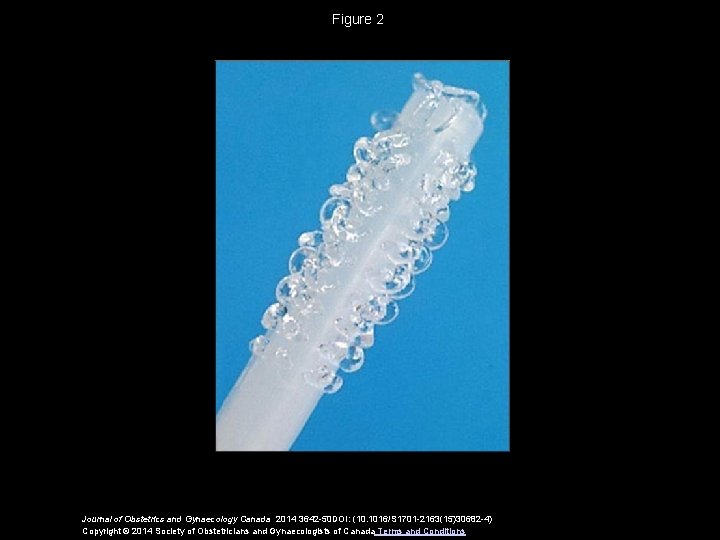 Figure 2 Journal of Obstetrics and Gynaecology Canada 2014 3642 -50 DOI: (10. 1016/S