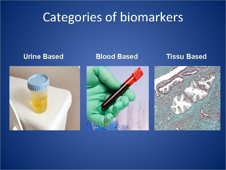 Categories of biomarkers Urine Based Blood Based Tissu Based 