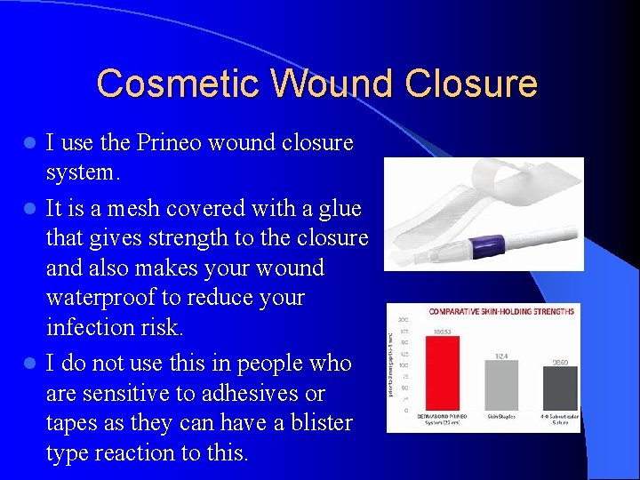 Cosmetic Wound Closure I use the Prineo wound closure system. l It is a