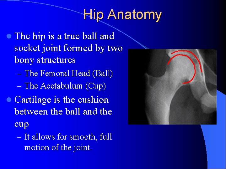 Hip Anatomy l The hip is a true ball and socket joint formed by