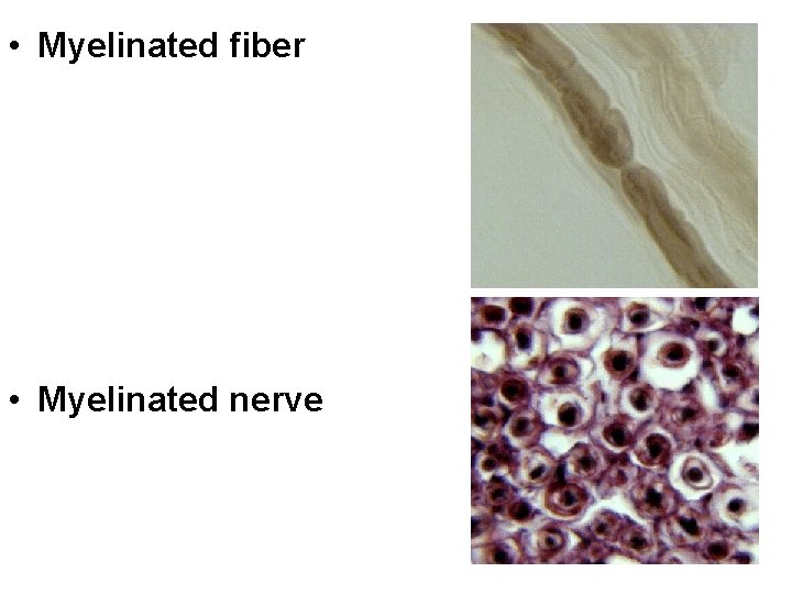  • Myelinated fiber • Myelinated nerve 