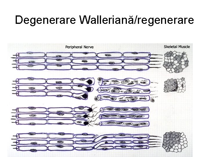 Degenerare Walleriană/regenerare 