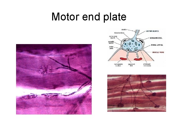 Motor end plate 