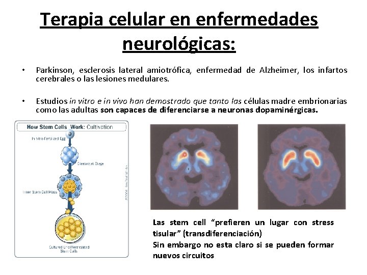 Terapia celular en enfermedades neurológicas: • Parkinson, esclerosis lateral amiotrófica, enfermedad de Alzheimer, los