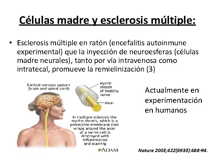 Células madre y esclerosis múltiple: • Esclerosis múltiple en ratón (encefalitis autoinmune experimental) que
