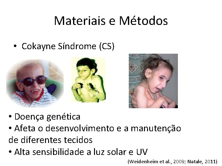 Materiais e Métodos • Cokayne Síndrome (CS) • Doença genética • Afeta o desenvolvimento