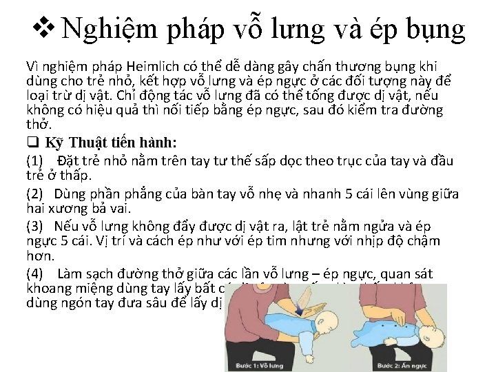 v Nghiệm pháp vỗ lưng và ép bụng Vì nghiệm pháp Heimlich có thể