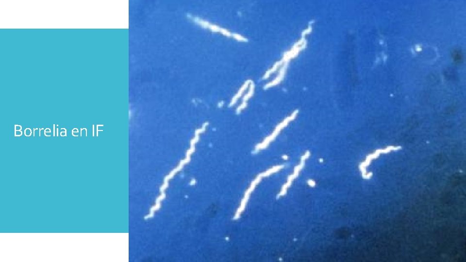Borrelia en IF 
