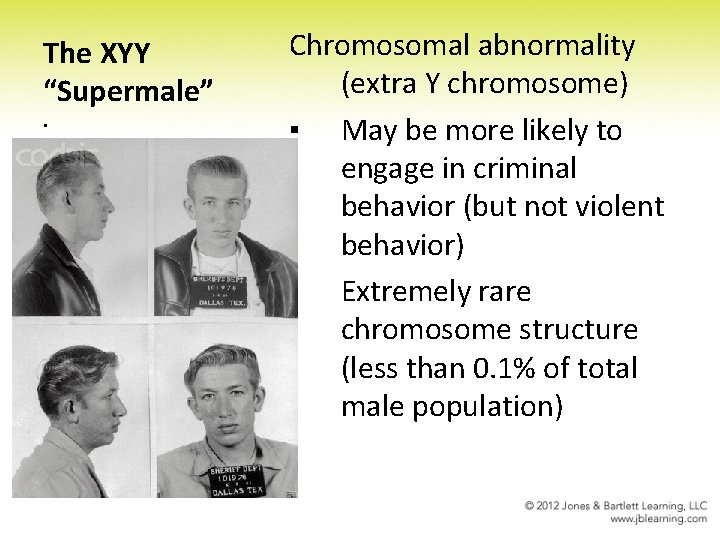 The XYY “Supermale” ▪ Chromosomal abnormality (extra Y chromosome) ▪ May be more likely