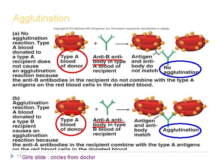 Agglutination 11 Girls slide : circles from doctor 