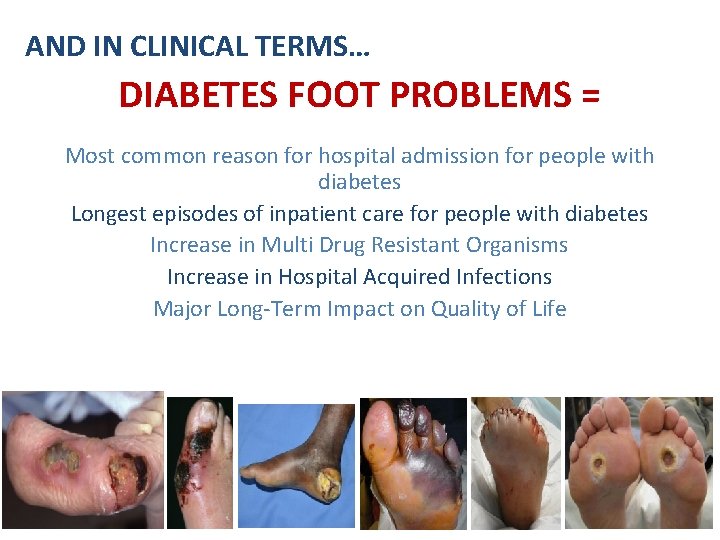 AND IN CLINICAL TERMS… DIABETES FOOT PROBLEMS = Most common reason for hospital admission
