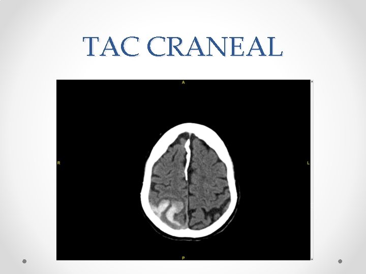 TAC CRANEAL 