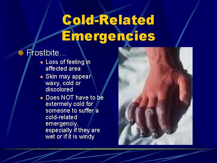 Cold-Related Emergencies Frostbite… l l l Loss of feeling in affected area Skin may