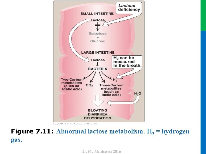 gas. Dr. M. Alzaharna 2016 Figure 7. 11: Abnormal lactose metabolism. H 2 =