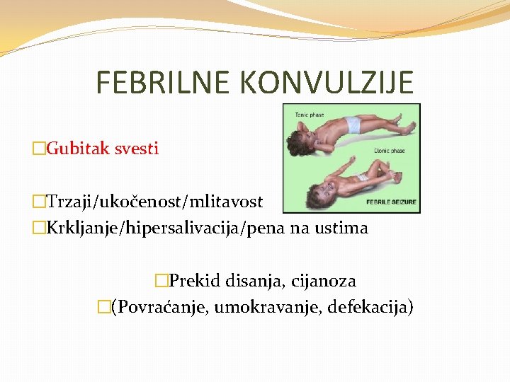 FEBRILNE KONVULZIJE �Gubitak svesti �Trzaji/ukočenost/mlitavost �Krkljanje/hipersalivacija/pena na ustima �Prekid disanja, cijanoza �(Povraćanje, umokravanje, defekacija)