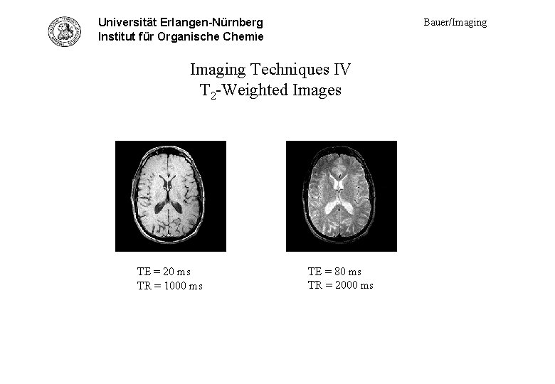 Universität Erlangen-Nürnberg Tech. IV - spin echo examp. Institut für Organische Chemie Imaging Techniques