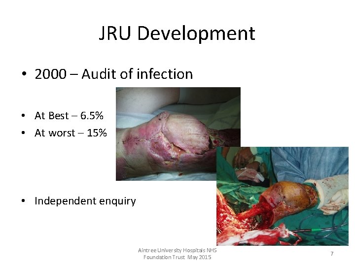 JRU Development • 2000 – Audit of infection • At Best – 6. 5%