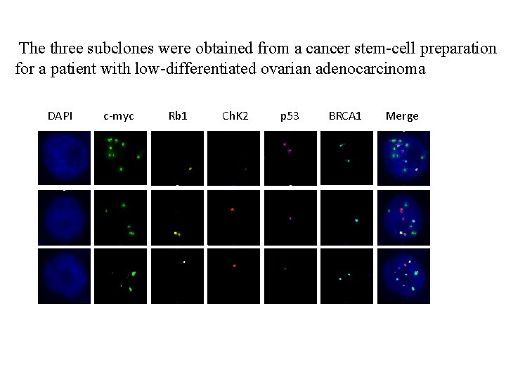 The three subclones were obtained from a cancer stem-cell preparation for a patient with