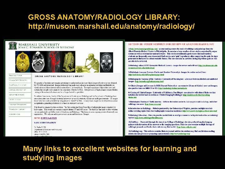 GROSS ANATOMY/RADIOLOGY LIBRARY: http: //musom. marshall. edu/anatomy/radiology/ Many links to excellent websites for learning