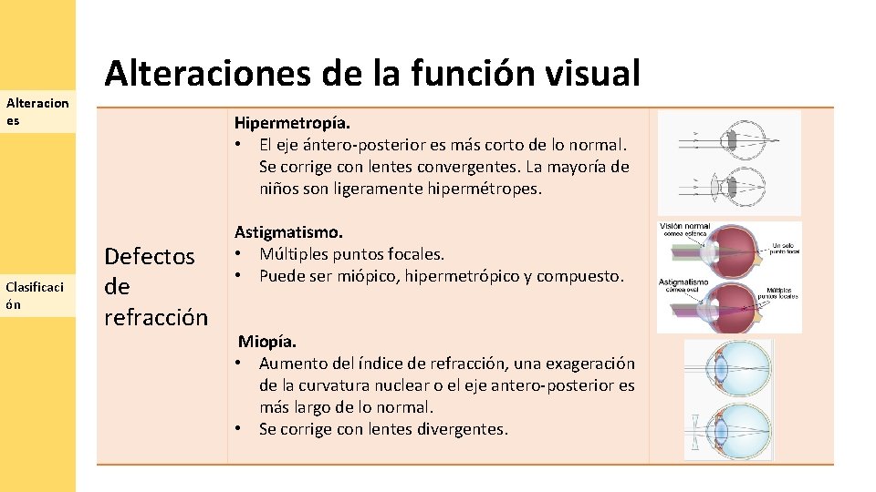 Alteracion es Clasificaci ón Alteraciones de la función visual Hipermetropía. • El eje ántero‐posterior