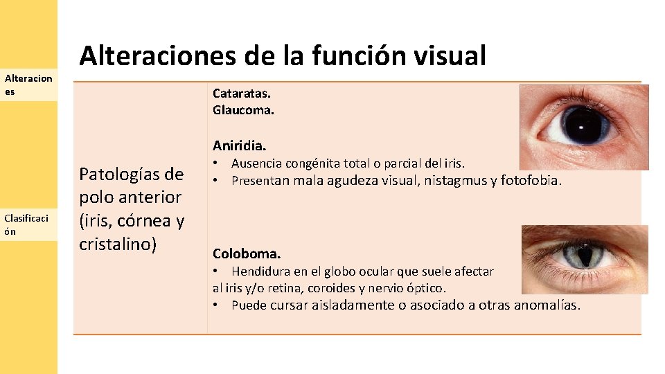 Alteracion es Alteraciones de la función visual Cataratas. Glaucoma. Aniridia. Clasificaci ón Patologías de
