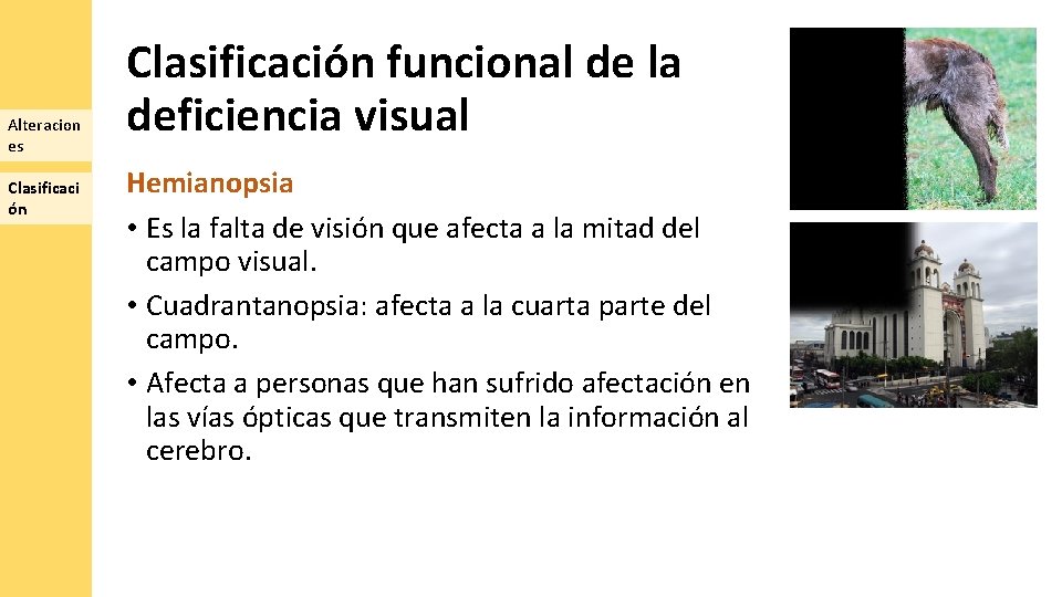 Alteracion es Clasificaci ón Clasificación funcional de la deficiencia visual Hemianopsia • Es la