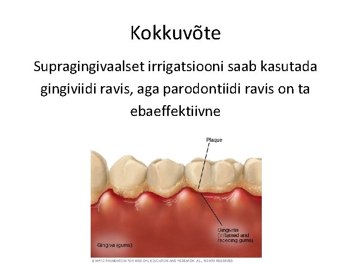 Kokkuvõte Supragingivaalset irrigatsiooni saab kasutada gingiviidi ravis, aga parodontiidi ravis on ta ebaeffektiivne 