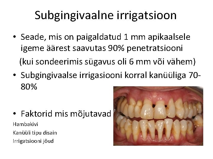 Subgingivaalne irrigatsioon • Seade, mis on paigaldatud 1 mm apikaalsele igeme äärest saavutas 90%