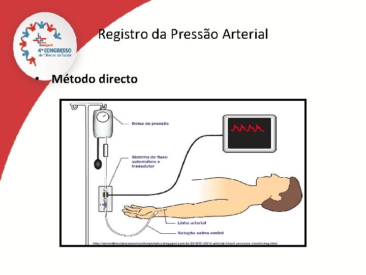 Registro da Pressão Arterial • Método directo 