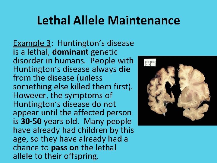 Lethal Allele Maintenance Example 3: Huntington’s disease is a lethal, dominant genetic disorder in