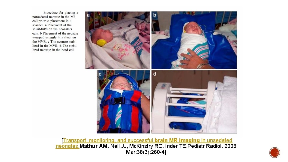  [Transport, monitoring, and successful brain MR imaging in unsedated neonates. Mathur AM, Neil